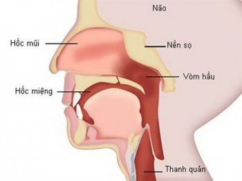 Dấu hiệu sớm của ung thư mũi xoang