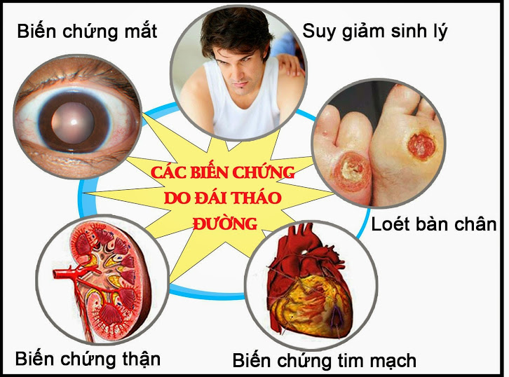 Thuốc làm giảm biến chứng đái tháo đường 