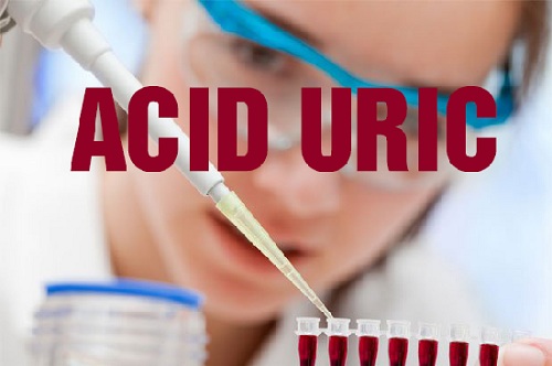 Tăng acid Uric máu và một số bệnh liên quan