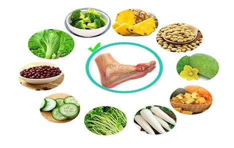 Bệnh gout và vấn đề ăn uống